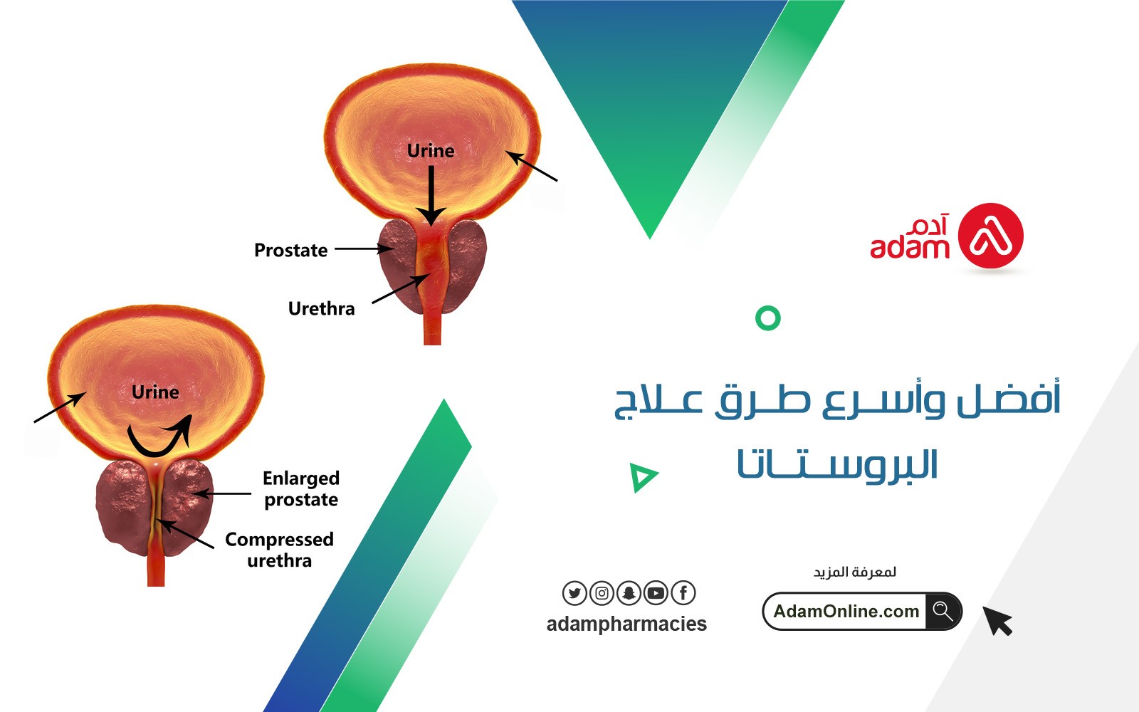 The best and fastest ways to treat prostate